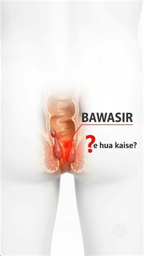 Blood During Bowel Movements? Is It Really Piles? 👀
