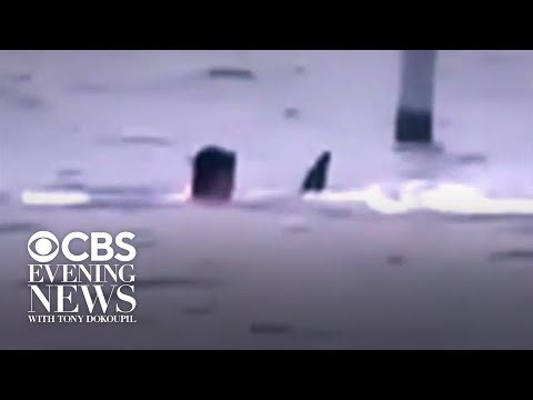 Florida man fights off shark, now in critical condition