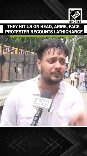 “They hit us on head, arms…” Protesting aspirant recounts lathicharge during 'Vidhan Sabha Gherao'