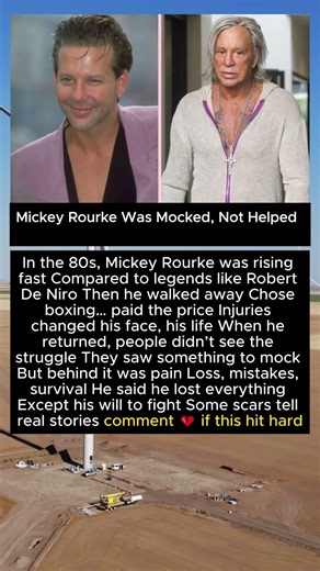 Mickey Rourke Was Mocked, Not Helped
