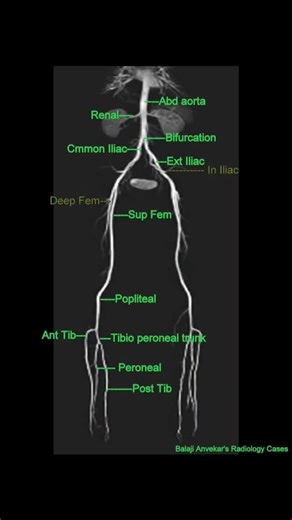 Aanya Paramedico on Instagram: "Lower limb artery #anatomy #lowerlimb #angio #angiography"