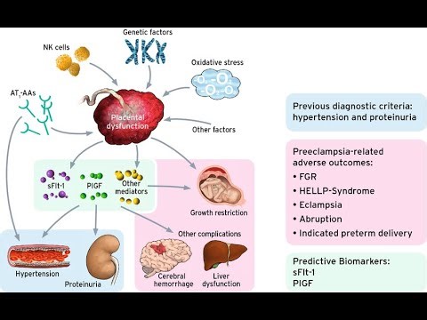 Pathophysiology of Eclampsia; seizures in a woman with preeclampsia