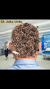 109K views · 308 reactions | Removal treatment for boy's back side head animation by doctor #asmrvideo #relaxing part 1 | SK Joks Urdu | Facebook