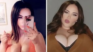 25yo’s boobs suddenly grow uncontrollably