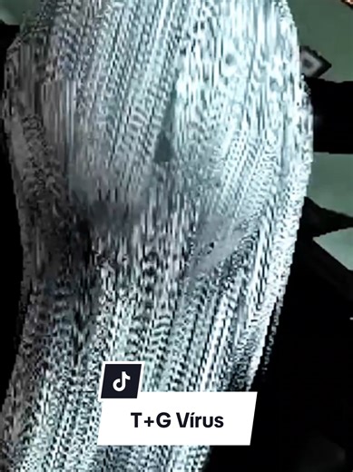 Um vírus capaz de gerar descargas elétricas? Sim! Em Resident Evil tudo é possível kkkkk . 🎮 Jogo: Dead Aim . #residentevil #tiktokgame #jogos #residentevil4 #residentevil9