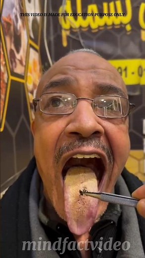 Bee Venom Therapy: Benefits and Risks #bee #beekeeping #beesting