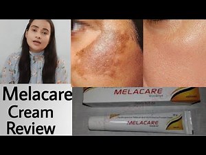 Melacare Cream Review |हिन्दी मैं | मेलाकेयर क्रीम उपयोग फायदे और नुकसान