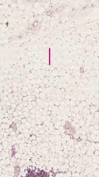 Classification of connective tissue proper #shorts