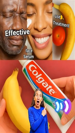 11 Natural Beauty Hacks Using Banana, Tomato, and Toothpaste (That Actually Work Safely!) Recipe in (c.o.m.m.e.n.t ).👇 | NextGen Health