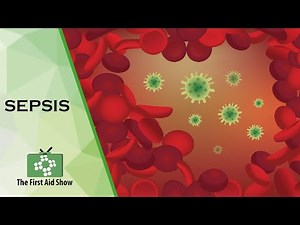 Sepsis