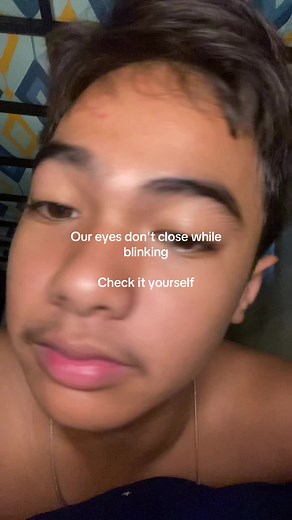Do Our Eyes Close While Blinking?