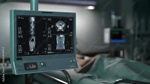 Disease diagnosis system scanning the patients body at the clinic. Disease diagnosis program scanning the sick persons chest. Disease diagnosis software scanning the damaged organs. Ward.