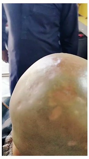 Girl Crying Headshave || Adil Barbar Salon || Headshave // Short Video