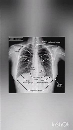 "X-Ray Anatomy Explained: A Clear View Inside the Human Body"