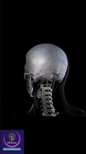 Neuro Surgery #surgeryanimation