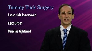What's Included in a Tummy Tuck? The Doctor Explains 4 Elements of the Procedure