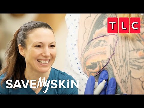 Relieving Lump Removals | Save My Skin | TLC