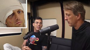 Tony Hawk recalls most life-threatening injury ever