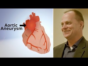 Valve Sparing Aortic Root Replacement (Tom's Patient Success Story)