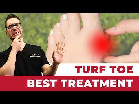 Turf Toe Injury BEST Treatment! [Causes, Symptoms & 3 Grades]