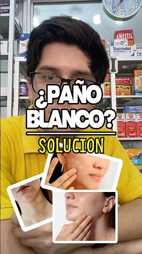The TRUTH about "Tinea Versicolor" (Pityriasis Versicolor) 🍄🩺