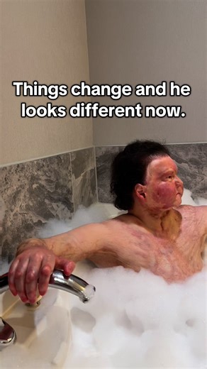 Dimeo Joe on Instagram: "Times change. Things happen. Your shell can transform, but you’re still the same person."