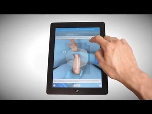 Touch Surgery Simulation - Close Reduction and Pinning of Pediatric Supracondylar Humerus Fracture