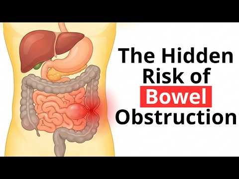 When a “Healthy” Meal Turns Dangerous: The Hidden Risk of Bowel Obstruction