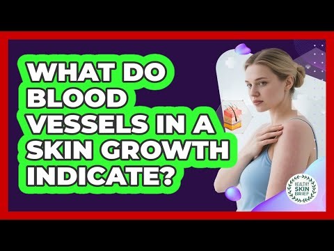 What Do Blood Vessels in a Skin Growth Indicate?