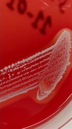 Staphylococcus aureus showing beta hemolysis on blood agar#microbiology#biology#scienceshorts