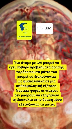 CVI