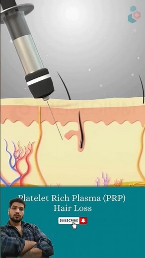 How Platelets rich plasma therapy ( PRP) works (3d animation) ⚕️👨‍⚕️