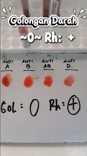 Penampakan Golongan darah ~O ~ Rh:+