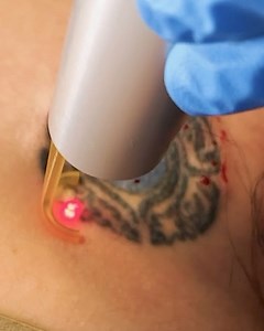 Contour Dermatology and Cosmetic Surgery Center on Reels | Facebook