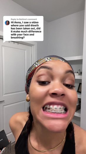 Can Braces Help After Tooth Extraction? Find Out Here!