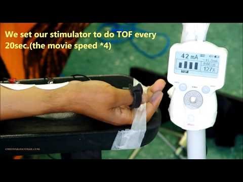 3-Neuromuscular monitoring, TOF for induction