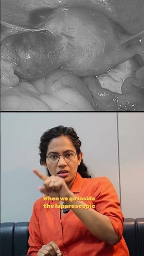 Understanding Ectopic Pregnancy: A Laparoscopic Perspective