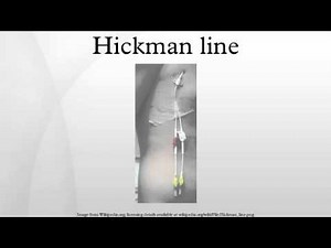 Hickman line