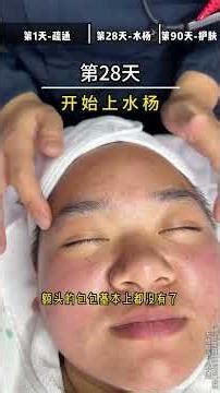 End of 90-Day T-zone Oil Blockage & Sensitive Cheeks Care - Unveil the Results