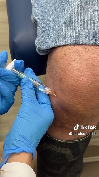 Pomona Arthritis & Joint Pain Relief Gel