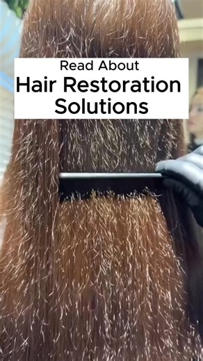 Learn more about hair restoration treatments and options | Health & Beauty Insights