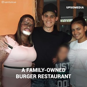 493K views · 7.8K reactions | Káh suffers from “xeroderma pigmentosum.” Her whole skin looks injured. This rare disease has no cure. The influencer has already undergone more than 150 surgeries… But her struggle continues. Now, having her baby has been a “miracle.” | Upbeat | Facebook