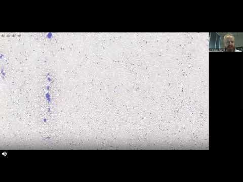 The Art and Science of Hematology Morphology: Platelet Morphology