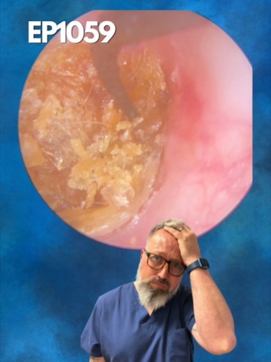 Effective Ear Wax Removal Techniques Explained