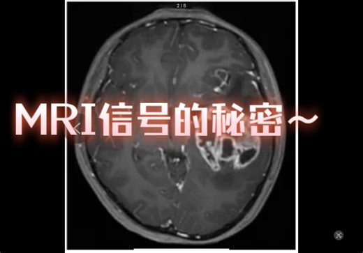 影像报告看不懂？一个视频为你解答MRI的信号之谜～Day3打卡，跟着学，从此看片不迷路！