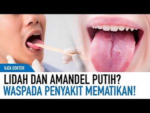 Lidah dan Tenggorokan Putih? Awas! Kenali Penyakit Mematikan Ini | Kata Dokter
