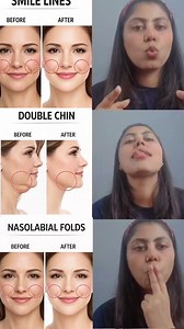 Erase Smile Lines & Nasolabial Folds Naturally 😱 | Face Yoga Transformation Before After