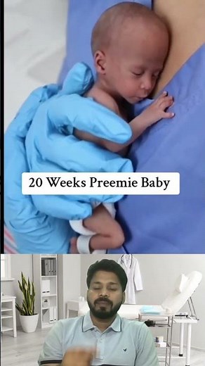 20 weeks preemie baby #shorts #baby #positivebirth #doctor #newborn #hospital #mbbs #premature