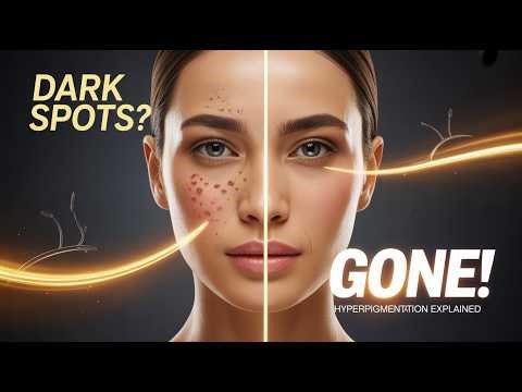 Hyperpigmentation Explained Causes, Types & Why It Happens