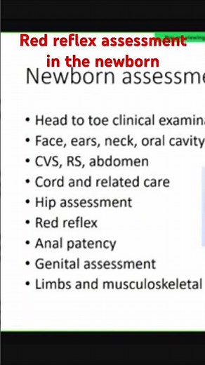 Red reflex assessment in the newborn #redreflex #newborn